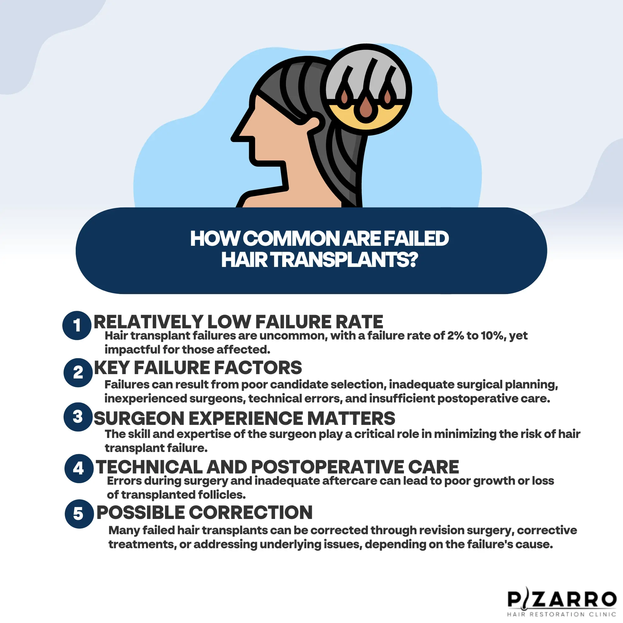 Why Do Hair Transplants Fail?