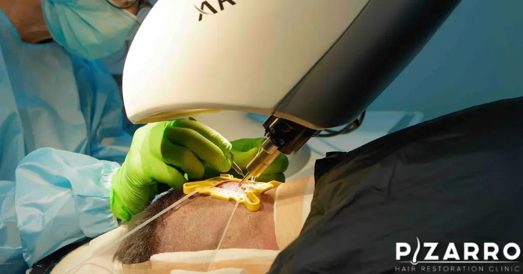 A man undergoing hair restoration procedure | PHR