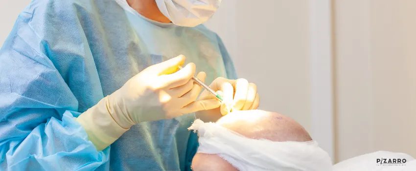 Types of Hair Restoration Surgery: Exploring Your Options